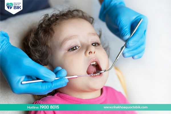 Điều trị sâu răng cho trẻ tại nha khoa