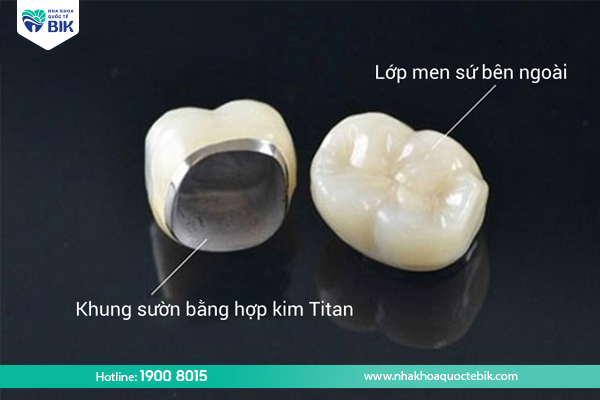 Cấu tạo răng sứ Titan
